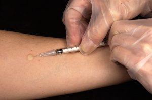 Meningite vaccinazione